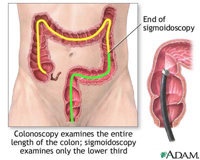 colonoscopy.jpg